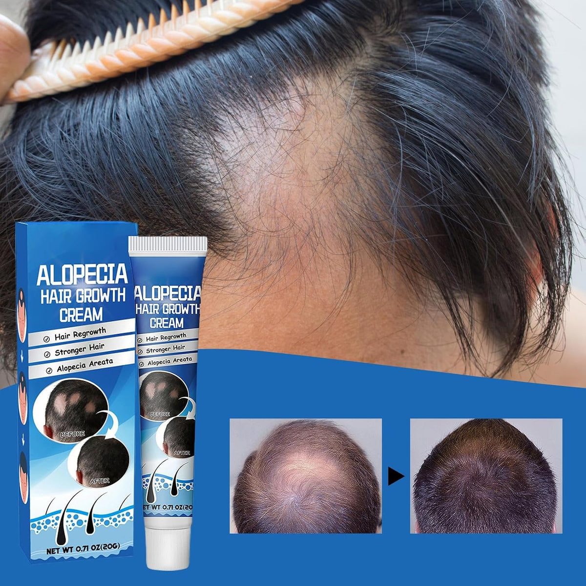 Crema para el crecimiento y cuidado del cabello – Tratamiento para la alopecia